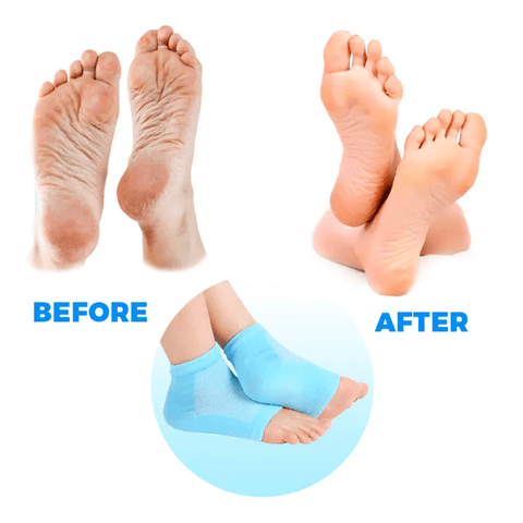 Toe-less Silicone Gel Heel Socks For Anti-Crack Foot Care And Heel Pain